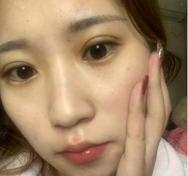 3种调料正在“悄悄”留下你皮下的黑色素提醒女性平时少吃(图1)