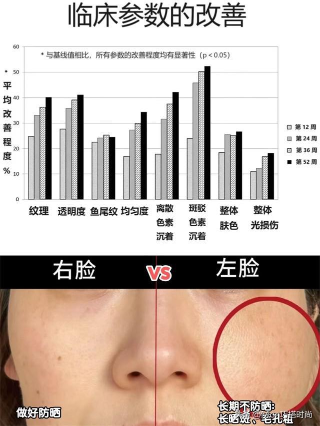 “长期防晒”对外貌影响有多大看完这几组对比图就懂！差别太大(图4)