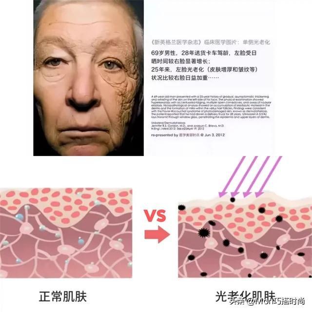 “长期防晒”对外貌影响有多大看完这几组对比图就懂！差别太大(图5)